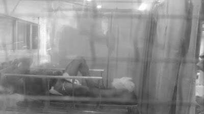 Woman cuts off husband's penis with scissors