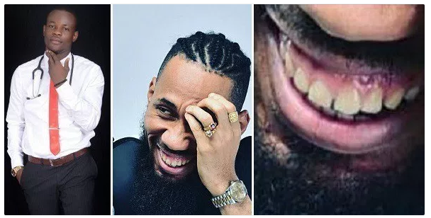 Nigerians blast dentist who said Phyno has brown teeth