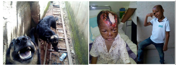 Mother of little boy attacked by two rottweilers