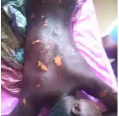 Teenage girl tortured with hot knife