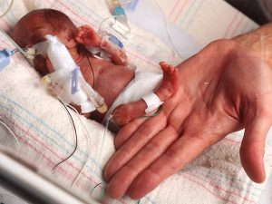 Smallest baby 