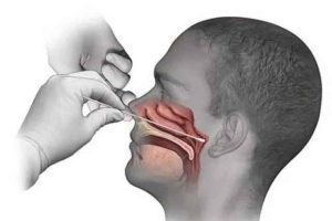 Nasopharyngeal swap COVID-19