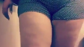 Lady Went For Butt Implants But